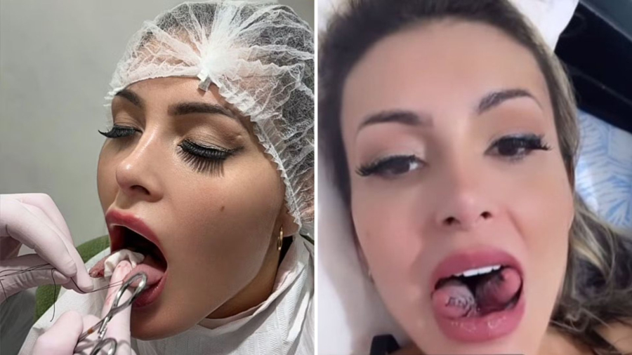 ARREPENDIDA? Andressa Urach abre o jogo sobre bifurcação da língua: “30 dias sem falar”