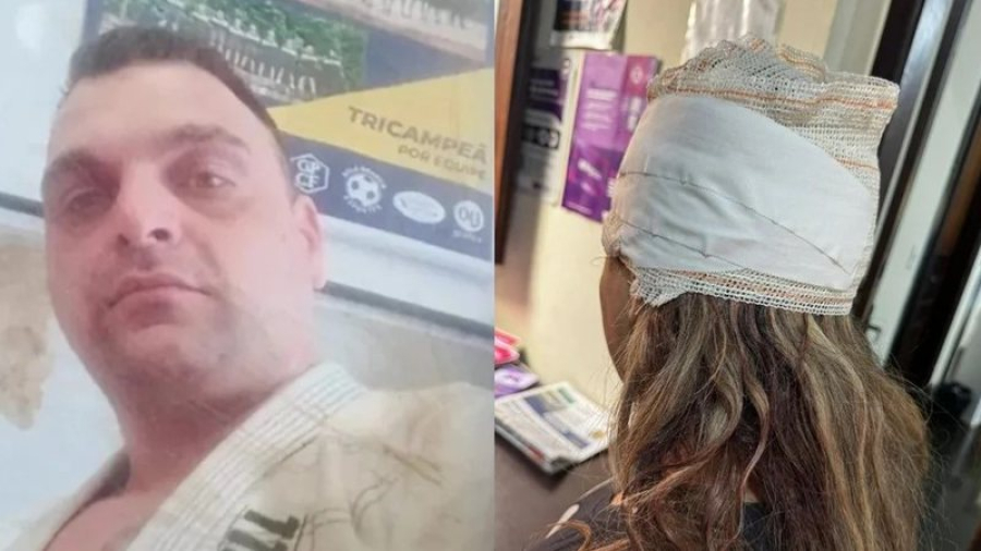 Lutador de jiu-jitsu espanca mulher com filha de 6 meses no colo por causa de barulho enquanto dormia; bebê ficou ferida após golpe